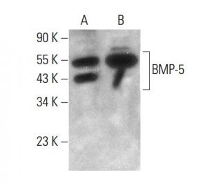 BMP-5 Antibody (MM0117-9G27) - Western Blotting - Image 376896