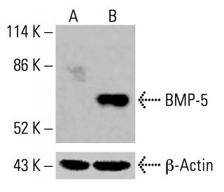 BMP-5 Antibody (MM0117-9G27) - Western Blotting - Image 416465 