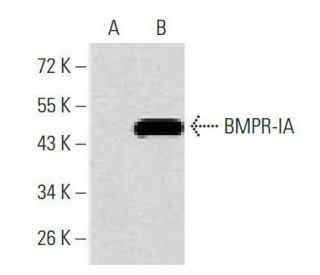 BMPR-IA Antibody (4B7B2) - Western Blotting - Image 358288 