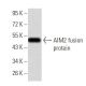 BMPR-IA Antibody (4B7B2) - Western Blotting - Image 358289