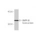 BMPR-IB Antibody (2E2) - Western Blotting - Image 348442