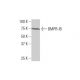 BMPR-IB Antibody (2E2) - Western Blotting - Image 352097 