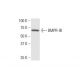 BMPR-IB Antibody (2E2) - Western Blotting - Image 352098 