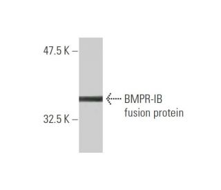 BMPR-IB Antibody (2E2) - Western Blotting - Image 348442