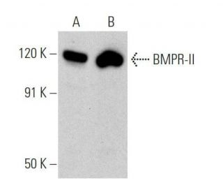 BMPR-II Antibody (E-1) - Western Blotting - Image 356296