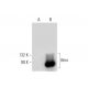 Bmx Antibody (D-6) - Western Blotting - Image 135979