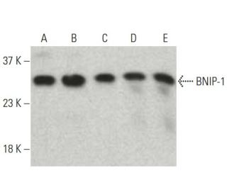 BNIP-1 Antibody (5) - Western Blotting - Image 396389 
