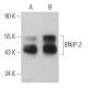 BNIP-2 Antibody (A-6) - Western Blotting - Image 367136 