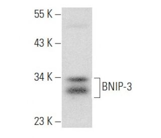 BNIP-3 Antibody (ANa40) - Western Blotting - Image 354932Each CRISPR/Cas9 Knockout (KO) Plasmid product consists of a pool of 3 plasmids designed to ensure identification and cleavage of a specific gene for maximum knockout efficiency. Each plasmid encodes a unique 20 nt sequence derived from the GeCKO (v2) library.