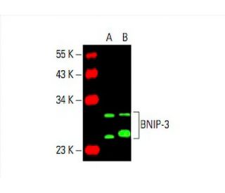 BNIP-3 Antibody (ANa40) - Western Blotting - Image 394854Each CRISPR/Cas9 Knockout (KO) Plasmid product consists of a pool of 3 plasmids designed to ensure identification and cleavage of a specific gene for maximum knockout efficiency. Each plasmid encodes a unique 20 nt sequence derived from the GeCKO (v2) library.