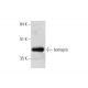 bomapin Antibody (B-3) - Western Blotting - Image 333357 