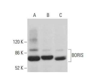 BORIS Antibody (F-1) - Western Blotting - Image 380884SAM Transcription Activation: SAM system utilizing dCas9-VP64, MS2-P65-HSF1, and sgRNA for precise gene transcription activation.