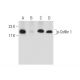 bpV(bipy): sc-221376. Western blot analysis of Cofilin 1 phosphorylation in K-562 (A), lambda phosphatase (sc-200312) trea