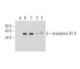 bradykinin B1 R Antibody (F-11) - Western Blotting - Image 397677Each CRISPR/Cas9 Knockout (KO) Plasmid product consists of a pool of 3 plasmids designed to ensure identification and cleavage of a specific gene for maximum knockout efficiency. Each plasmid encodes a unique 20 nt sequence derived from the GeCKO (v2) library. 