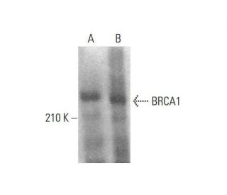BRCA1 Antibody (287.17) - Western Blotting - Image 350725 