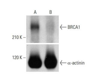BRCA1 CRISPR/CAS9 KO Plasmid (h): sc-400093. Western blot analysis of BRCA1 expression in empty vector control (A) and BRC 