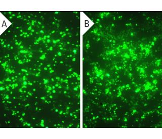 BRCA1 CRISPR/CAS9 KO Plasmid (h): sc-400093. GFP expression in empty vector control (A) and BRCA1 CRISPR/CAS9 KO Plasmid ( 