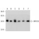 BRCC3 Antibody (AT3B1) - Western Blotting - Image 385114 