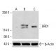 Anticorpo BRD1 (F-12): sc-398226. Analisi Western blot dell'espressione di BRD1 in lisati cellulari totali K-562 (A) non trattati, K-562 (B) trattati chimicamente e HeLa (C). β-Actina (C4): sc-47778 utilizzata come controllo di caricamento. Reagente di rilevamento utilizzato: m-IgG Fc BP-HRP: sc-525409. BRD1 Antibody (F-12) - Western Blotting - Image 415412