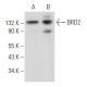 BRD2 Antibody (D-2) - Western Blotting - Image 357174 
