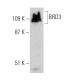BRD3 Antibody (B-12) - Western Blotting - Image 363237 
