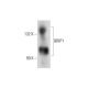 BRIP1 Antibody (E-11) - Western Blotting - Image 144554 