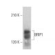 BRIP1 Antibody (E-11) - Western Blotting - Image 360708