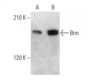 Brm Antibody (E-1) - Western Blotting - Image 356232The Double Nickase Plasmid features a U6 promoter for sgRNA expression, a 20 nt targeting sequence, and a gRNA scaffold to guide Cas9n. It includes a CBh promoter for Cas9n (D10A) and puromycin resistance, GFP for transfection verification, and nuclear localization signals (NLS). The 2A peptide allows co-expression of Cas9n and Puro from a single promoter, enabling precise genome editing with reduced off-target effects. 