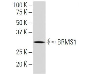 BRMS1 Antibody (4H7) - Western Blotting - Image 34578