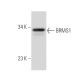 BRMS1 Antibody (4H7) - Western Blotting - Image 39547 
