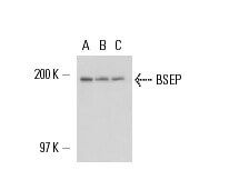 Bsep Form BSEP抗体 (F-6) | SCBIO - Santa Cruz Biotechnology