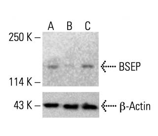 BSEP Antibody (F-6) - Western Blotting - Image 412657SAM Transcription Activation: SAM system utilizing dCas9-VP64, MS2-P65-HSF1, and sgRNA for precise gene transcription activation.