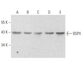 BSPII Antibody (LFMb-25) - Western Blotting - Image 357121Each CRISPR/Cas9 Knockout (KO) Plasmid product consists of a pool of 3 plasmids designed to ensure identification and cleavage of a specific gene for maximum knockout efficiency. Each plasmid encodes a unique 20 nt sequence derived from the GeCKO (v2) library.