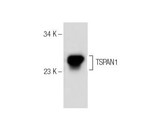 TSPAN1 (H-92): sc-292055. Western blot analysis of TSPAN1 expression in BT-20 whole cell lysate. 