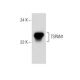 TSPAN1 (H-92): sc-292055. Western blot analysis of TSPAN1 expression in BT-20 whole cell lysate. 