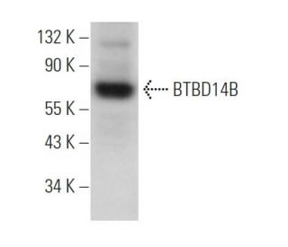 BTBD14B Antibody (E-3) - Western Blotting - Image 371730SAM Transcription Activation: SAM system utilizing dCas9-VP64, MS2-P65-HSF1, and sgRNA for precise gene transcription activation.