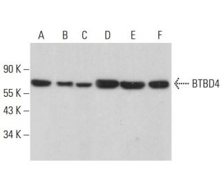 BTBD4 Antibody (C-5) - Western Blotting - Image 381381 
