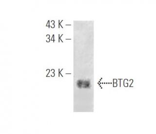 BTG2 Antibody (E-4) - Western Blotting - Image 395670Each CRISPR/Cas9 Knockout (KO) Plasmid product consists of a pool of 3 plasmids designed to ensure identification and cleavage of a specific gene for maximum knockout efficiency. Each plasmid encodes a unique 20 nt sequence derived from the GeCKO (v2) library.