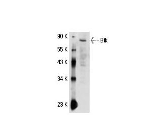 Btk Antibody (10d11) - Western Blotting - Image 17838