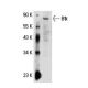 Btk Antibody (10d11) - Western Blotting - Image 17838