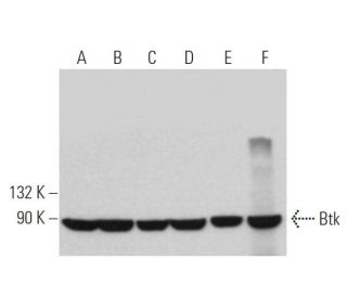 Btk Antibody (7F12H4) - Western Blotting - Image 361543 