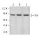 Btk Antibody (DFW) - Western Blotting - Image 354434
