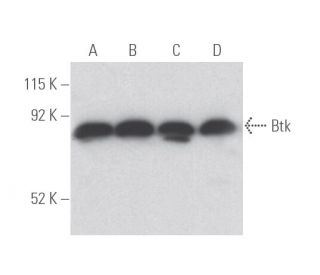 Btk Antibody (7F12H4) - Western Blotting - Image 398059