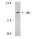 BUB1 Antibody (14H5) - Western Blotting - Image 13599 