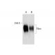 Butein: sc-202510. Western blot analysis of Neu expression in untreated (A) and Butein treated (B) SK-BR-3 whole cell lysa