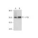 c-Fgr Antibody (C-11) - Western Blotting - Image 318366 