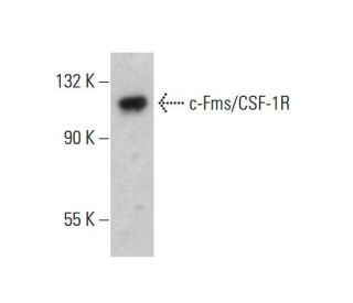c-Fms/CSF-1R Antibody (0.N.179) - Western Blotting - Image 377041