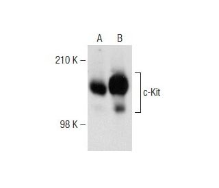 c-Kit Antibody (E-1) - Western Blotting - Image 141687 