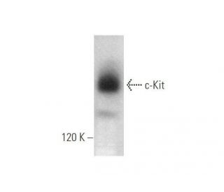 c-Kit Antibody (E-3) - Western Blotting - Image 349933 