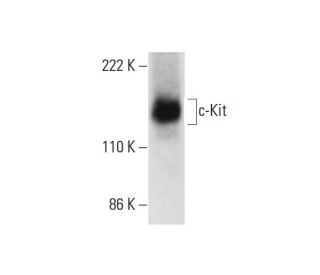 c-Kit Antibody (H-10) - Western Blotting - Image 299237 